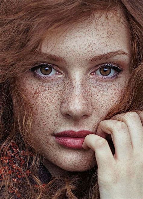 teen redhead|98 Freckled People Who’ll Hypnotize You With Their Unique Beauty